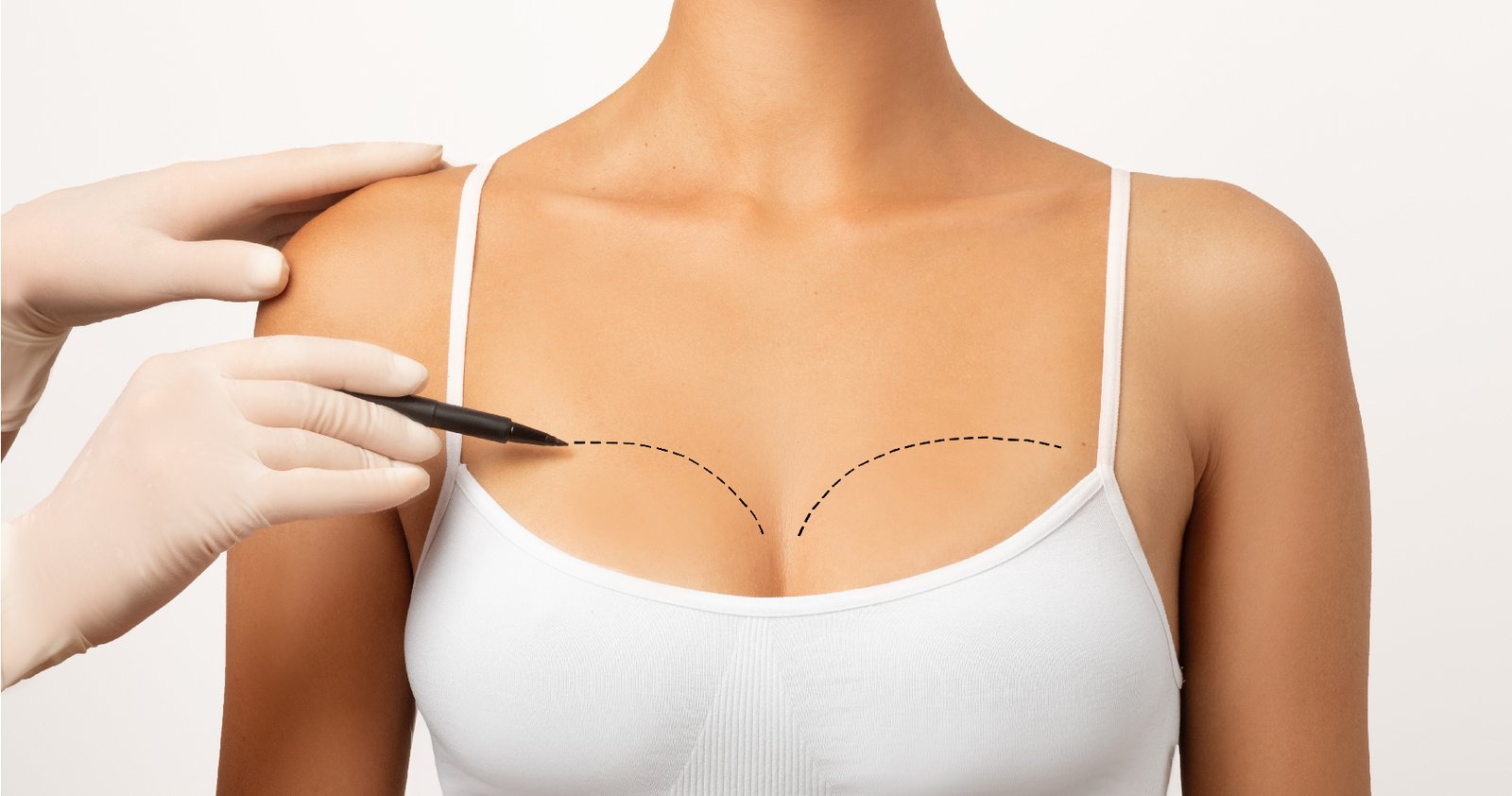 Breast Lift Surgery in Bangalore